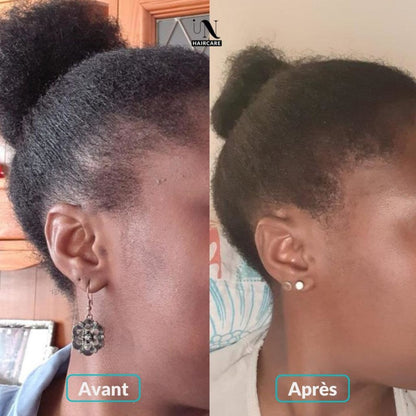 Huile de Batana™ | Soins Cheveux