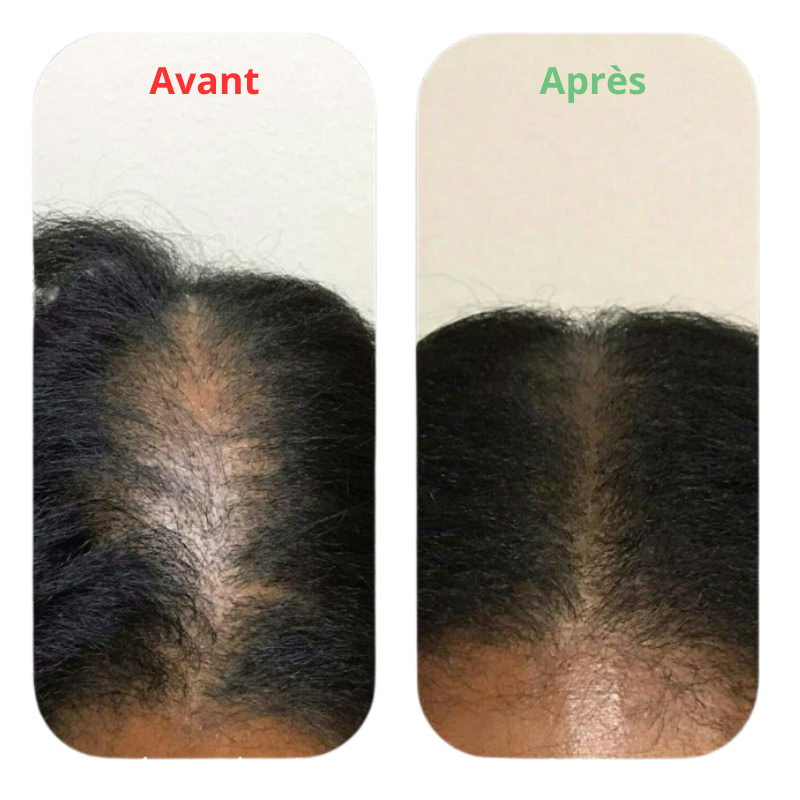 Huile de Batana™ | Soins Cheveux